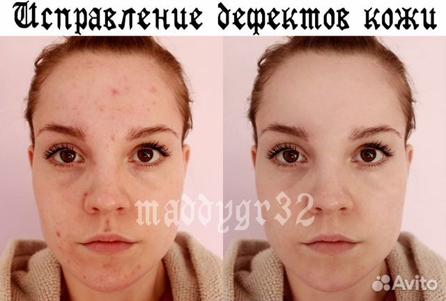 Изменение Фото Для Авито