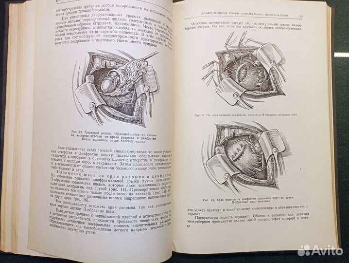 Джанелидзе. т. 3 1953. Хирургия легких