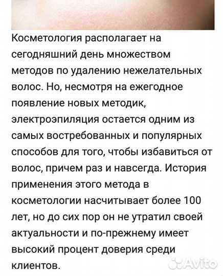 Электроэпиляция