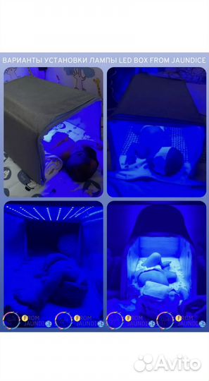 Уф лампа от желтушки