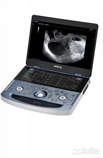 Узи-аппарат Mindray MX7