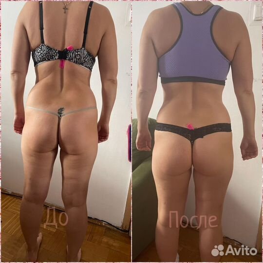 Вакуумно-роликовый массаж starvac