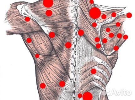 Профессиональный массаж. Устранение болей