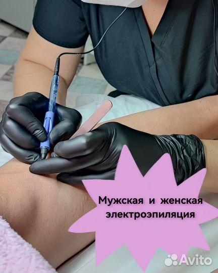 Электроэпиляция