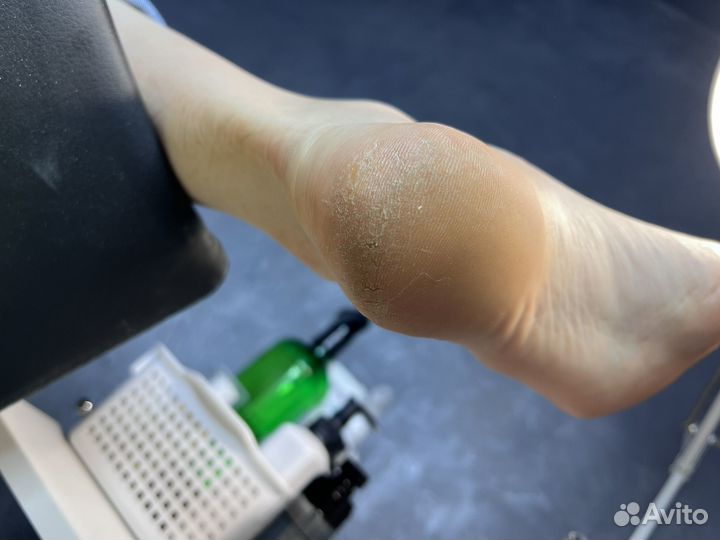 Модель на педикюр