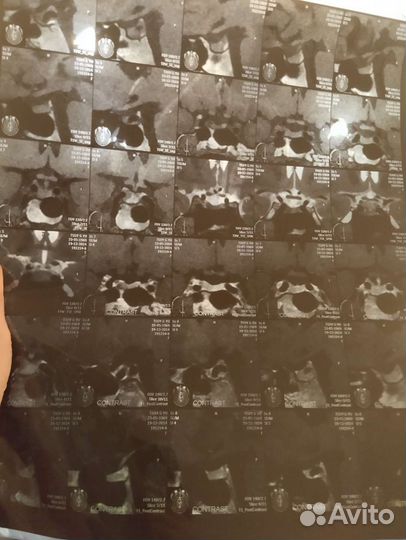 Рентгеновский снимок мрт