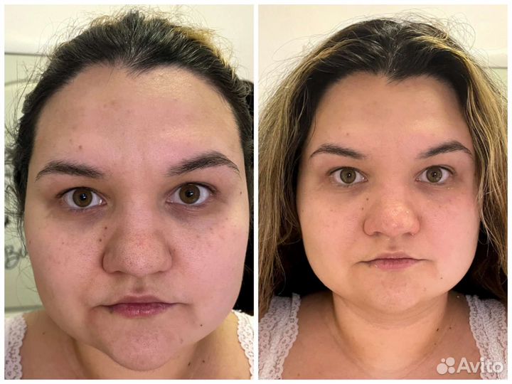 Скульптурный массаж лица