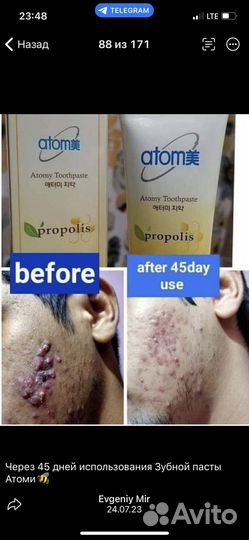 Корейская зубная паста с прополисом