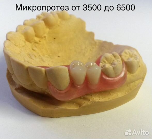 Изготовление зубных протезов (зубов )