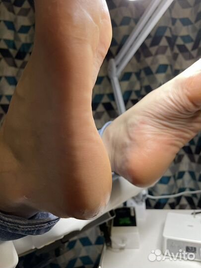 Смарт педикюр