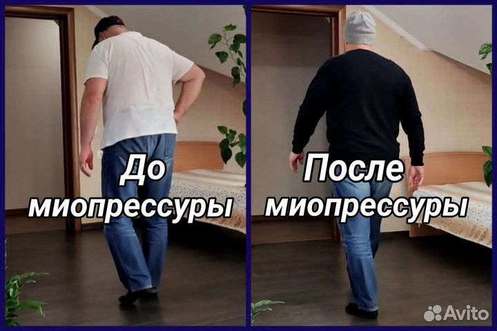 Глубокомышечный массаж Миопрессура