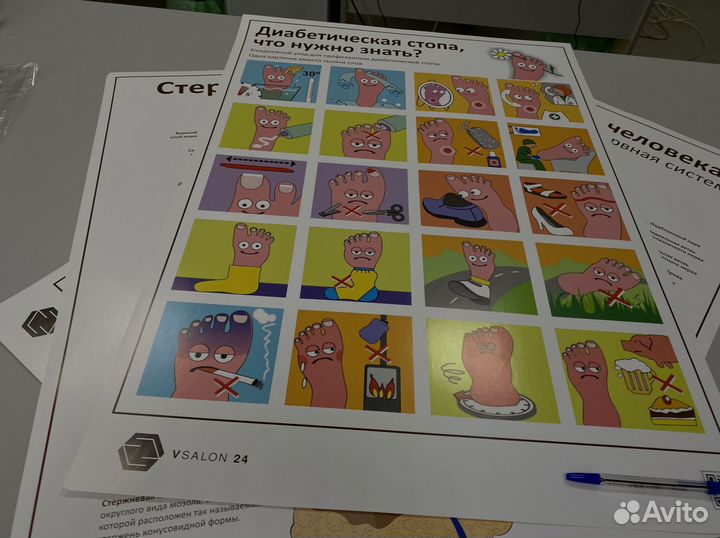 Плакат диабетическая стопа