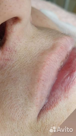 Депиляция воском