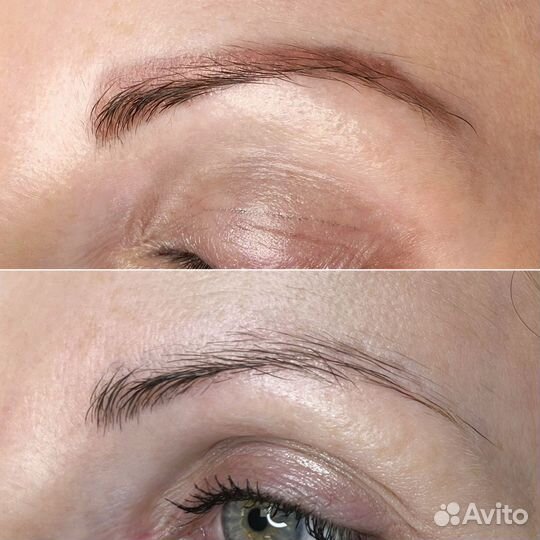 Удаление тату и татуажа