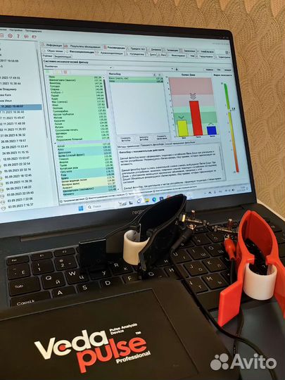 Ведапульс- аппарат пульсовой диагностики. Аюрведа