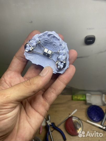 Ортодонтические пластинки