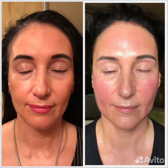 Практикующий массажист. Массаж лица