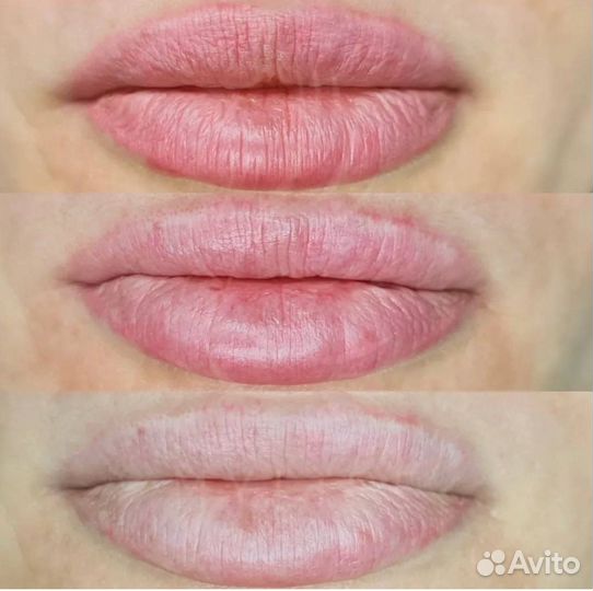 Удаление тату татуажа любых цветов