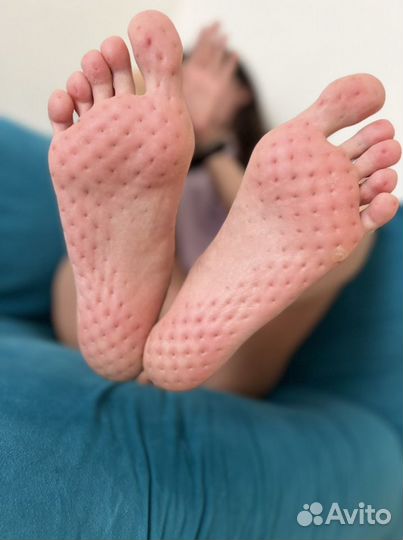 Гвоздестояние Психолог Расстановка