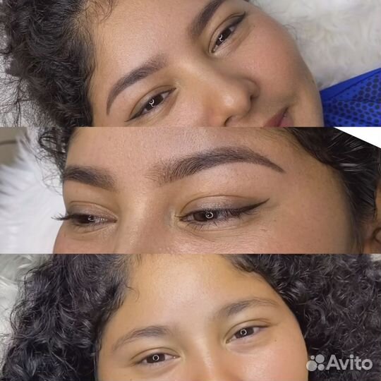 Гиперестественные брови Аппаратные волоски
