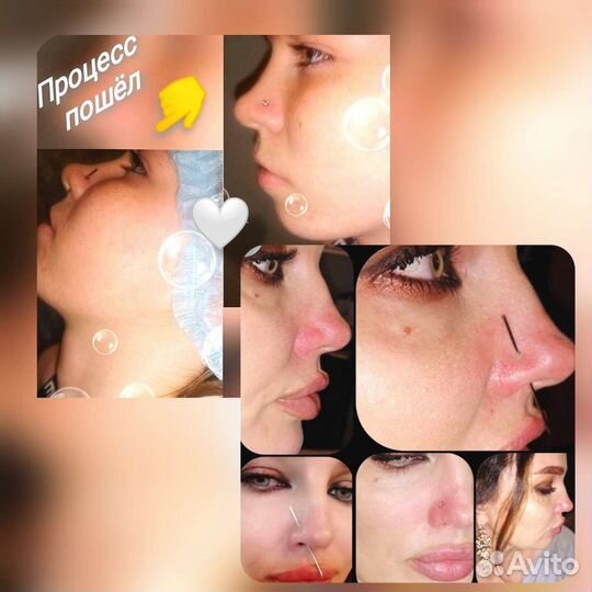 Прокол ушей, пирсинг