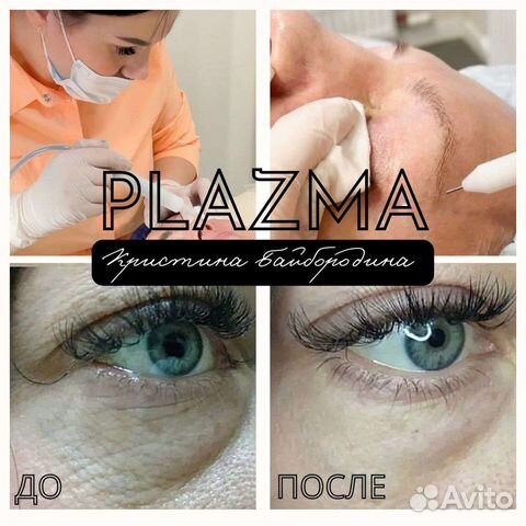 Холодная плазма в Санкт-Петербурге | Услуги | Авито