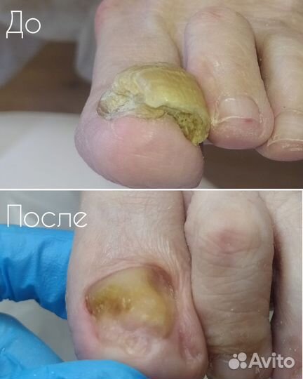 Подолог екатеринбург