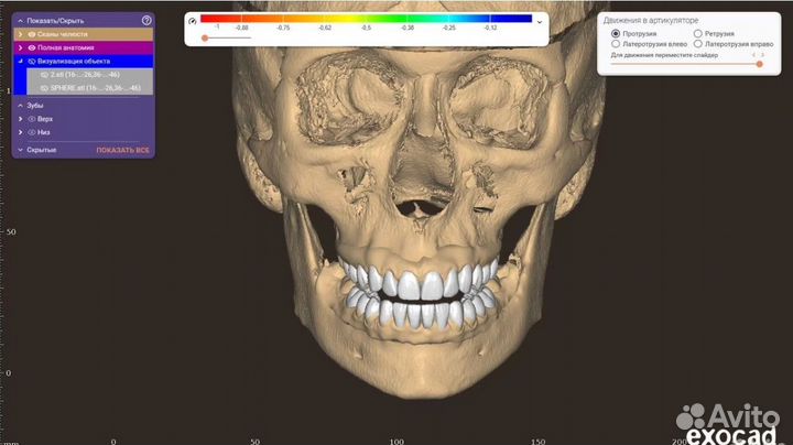 ExoCad 3.1 Rijeka ExoCad 3.0 Galway + Обучение