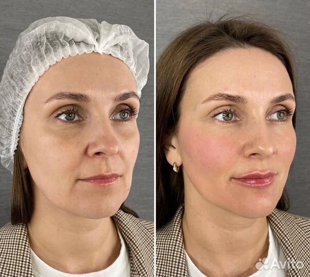 Аппаратный массаж лица и тела