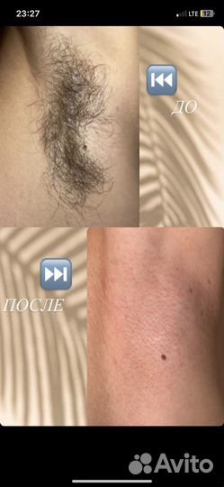 Шугаринг на дому модель