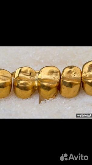 Золотые коронки