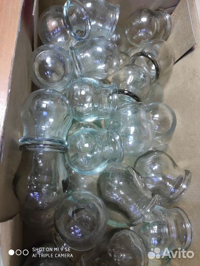 Банки медицинские со времен СССР для лечения