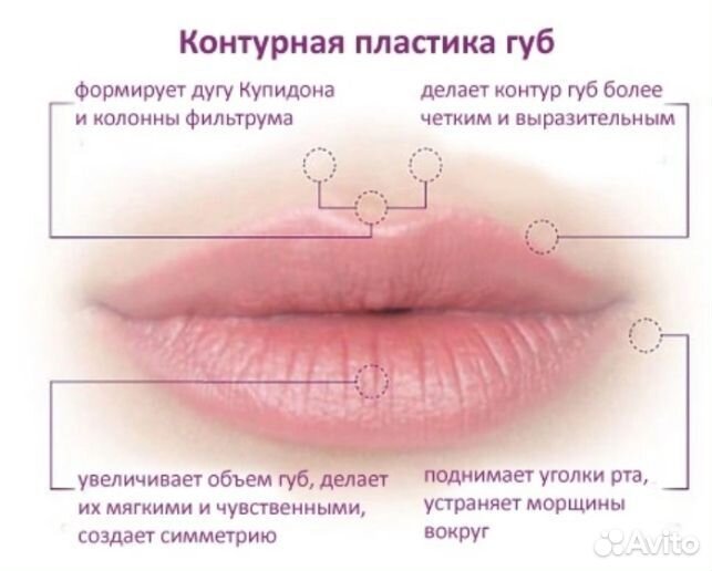 Обучение по контурной пластики губ