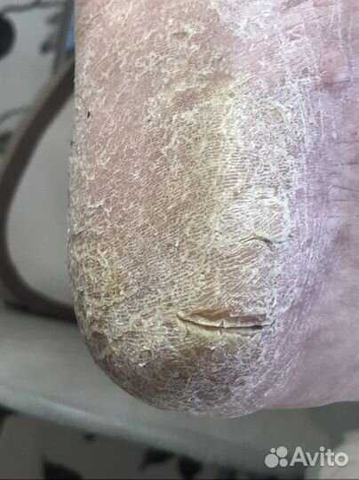 Услуги подолога