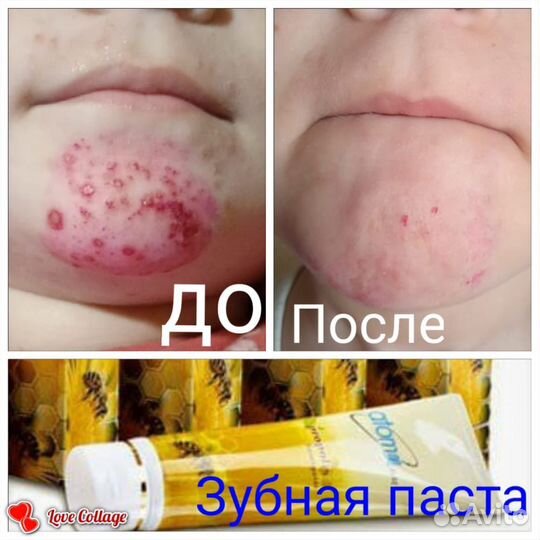 Зубная паста атоми