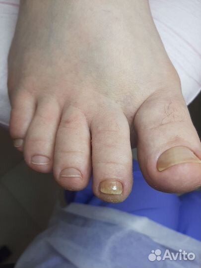 Мужской, женский педикюр