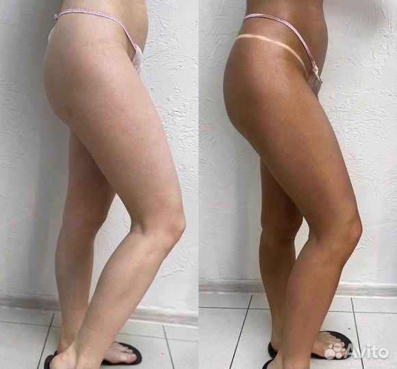 Безопасный моментальный загар с выездом на дом