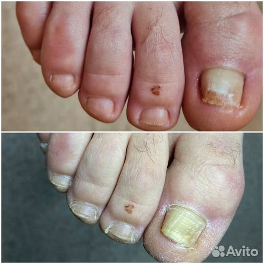 Подолог, педикюр