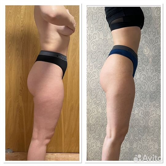 Массаж ручной и аппаратный