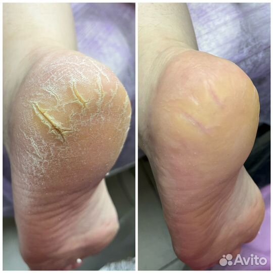 Маникюр, педикюр, гель-лак (шелак, шеллак, shellac