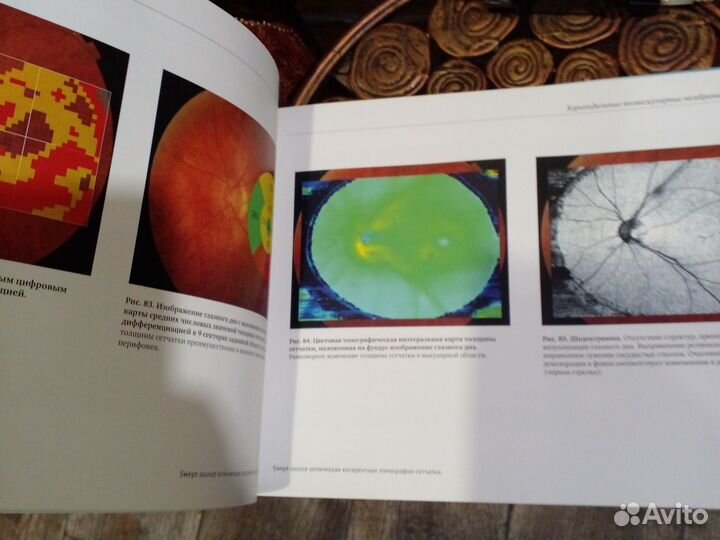 Книга Оптическая томография сетчатки