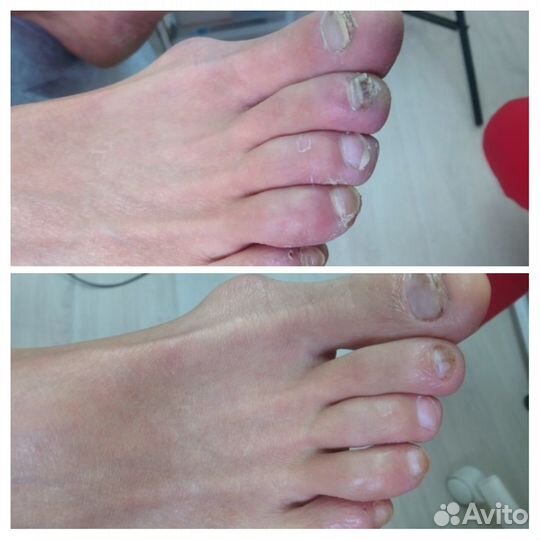 Подология и эстетический педикюр, маникюр, подолог