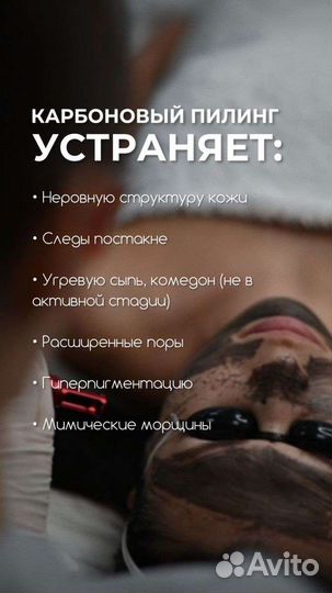 Карбоновый пилинг