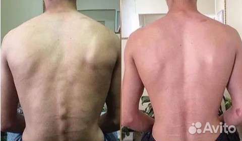 Мануальный массаж(Костоправ)