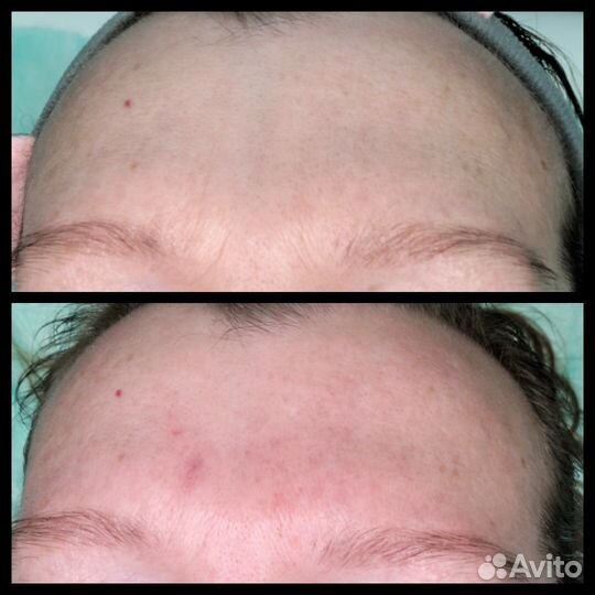 Услуги косметолога