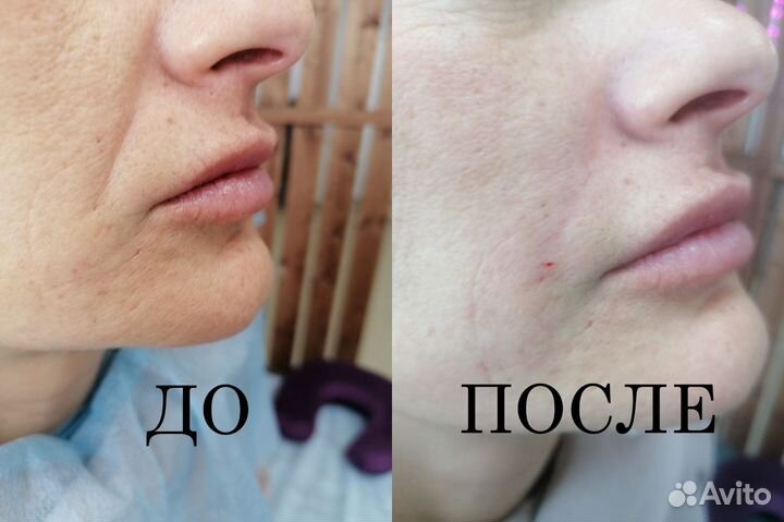 Услуги косметолога