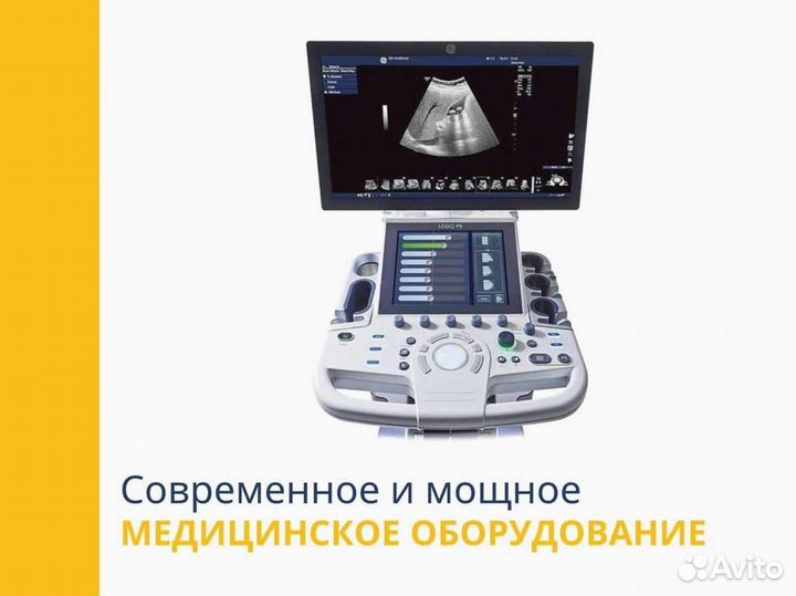 Узи GE Voluson S10