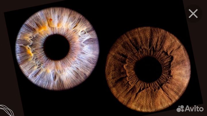 Фото радужки глаза