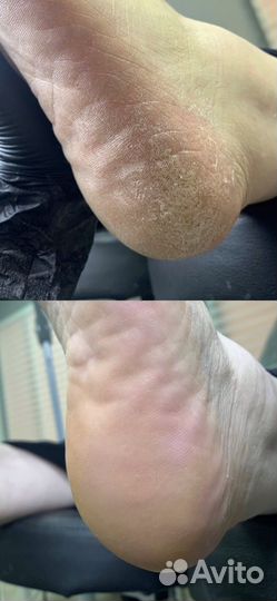 Маникюр, педикюр