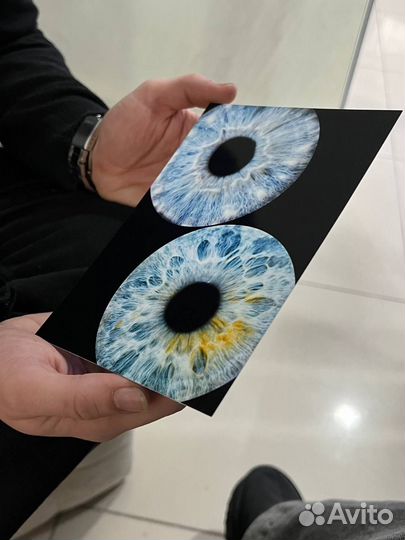 Фотография радужки глаза
